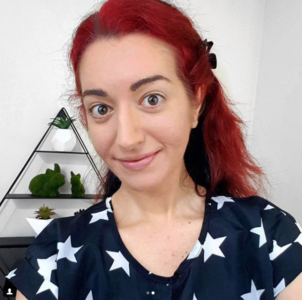 Woman with severe acne reveals how she hides her spots