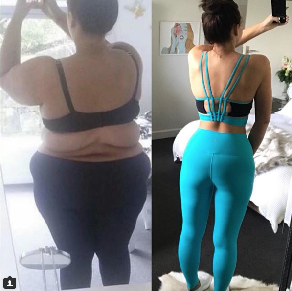 Woman who lost 92kg shows off brand new bum!