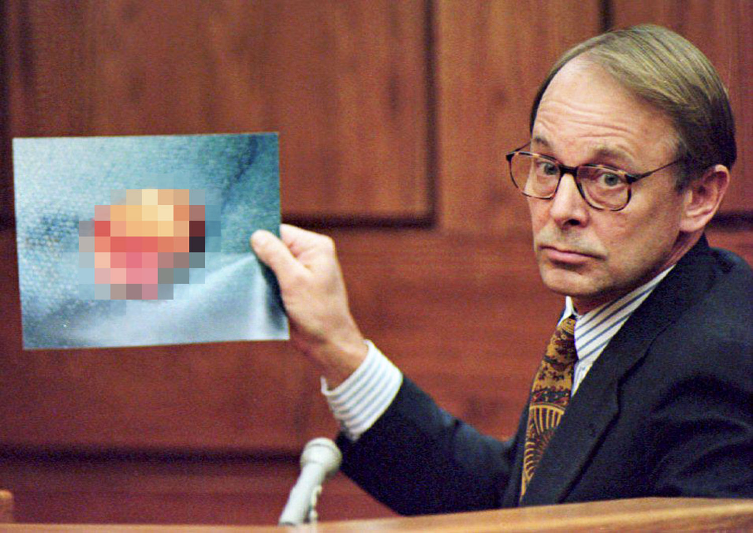 A picture of the severed organ was shown in court and the case created a media firestorm.