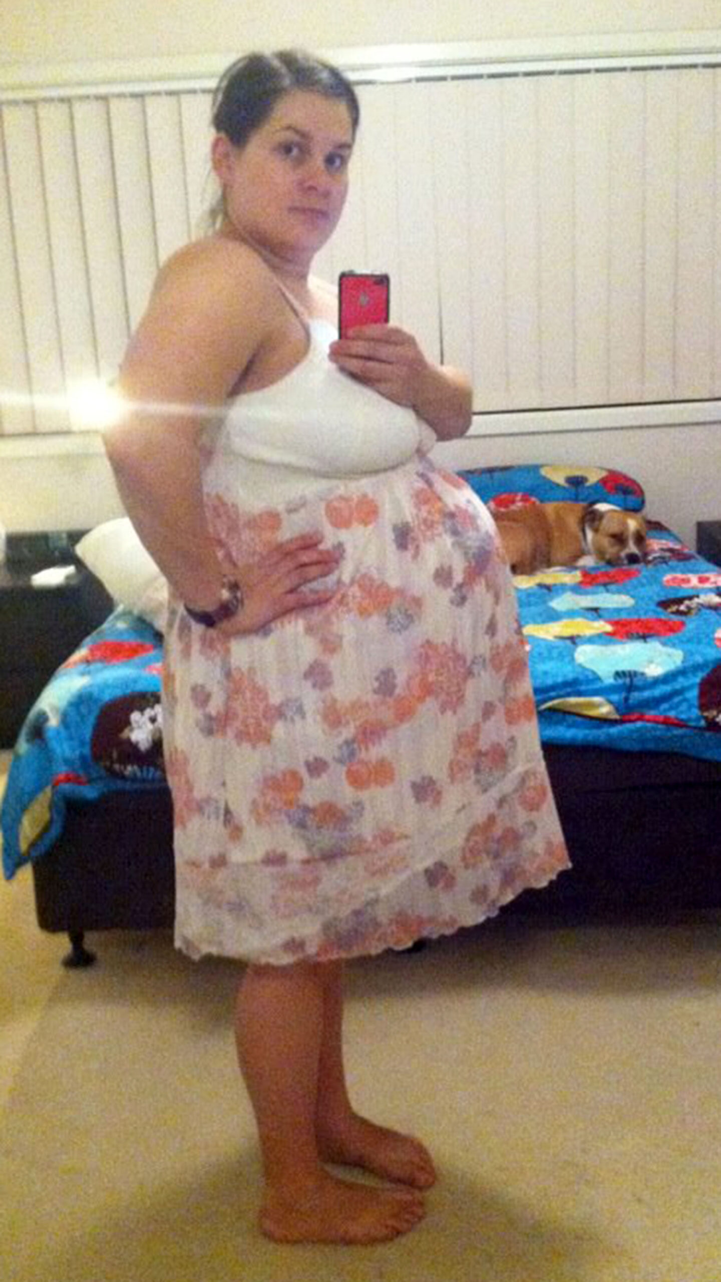 Perth woman loses 56kg after being fat shamed in Bali